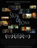 skin and bone